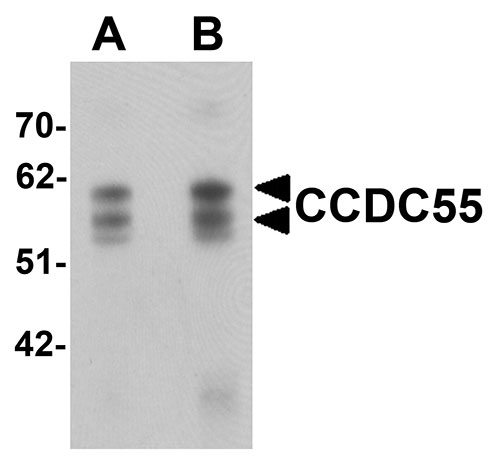 WB - CCDC55 Antibody ASC11384